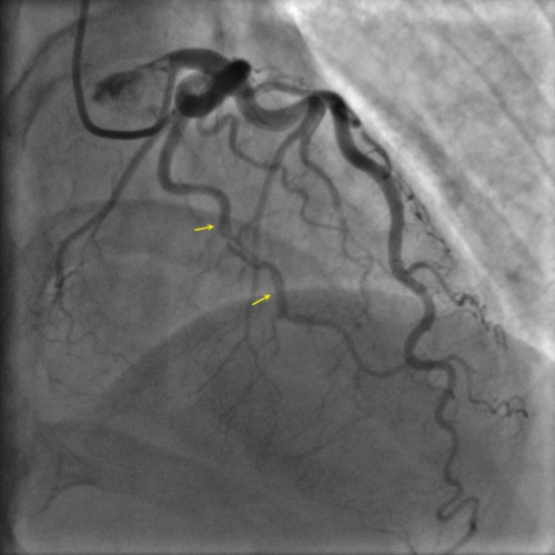 28-2 type 1 14RAO35CRA.jpg